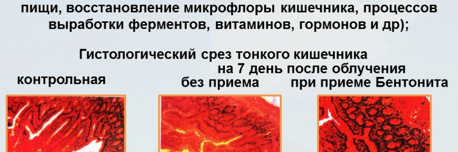 Коронавирус и «ЗЬОДА ЖИВА». Протокол исследования. Аннотация.